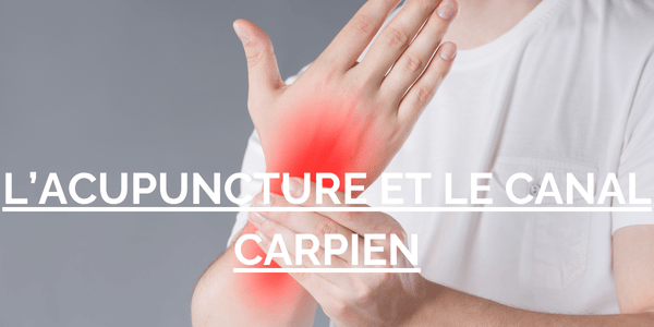 douleur au canal carpien