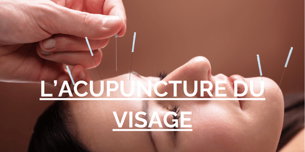 acupuncture du visage